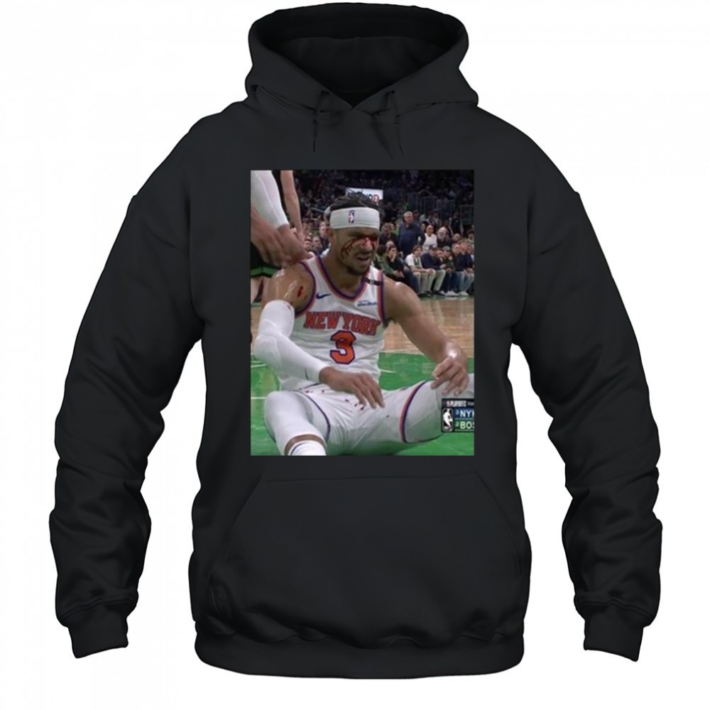 Photos Of Josh Hart After Getting Elbowed In The Face New York Knicks t-shirt