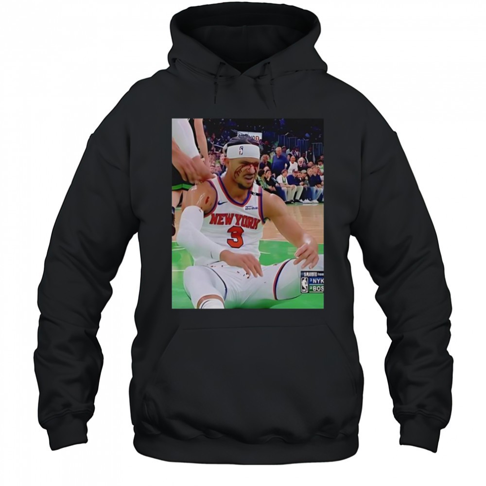 Photos Of Josh Hart After Getting Elbowed In The Face T-Shirt